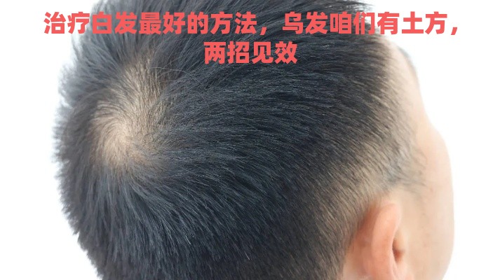 治疗白发最好的方法，乌发咱们有土方，两招见效