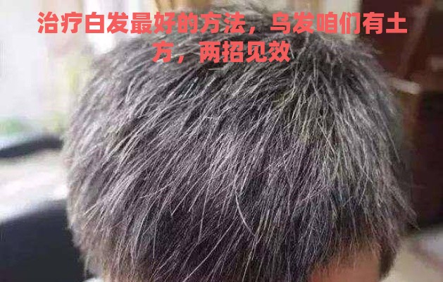 治疗白发最好的方法，乌发咱们有土方，两招见效