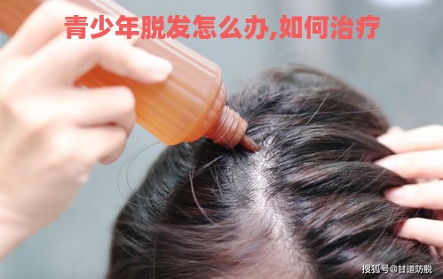 青少年脱发怎么办,如何治疗